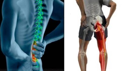 نقص فيتامين (د) يسبب آلام أسفل الظهر