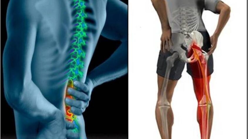 نقص فيتامين (د) يسبب آلام أسفل الظهر